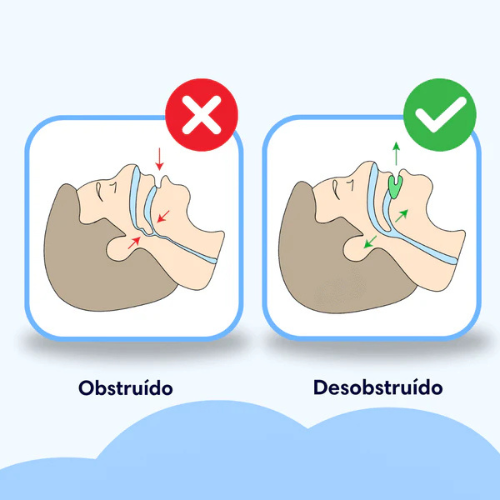 Silent Pro protector bucal anti ronquidos, bruxismo