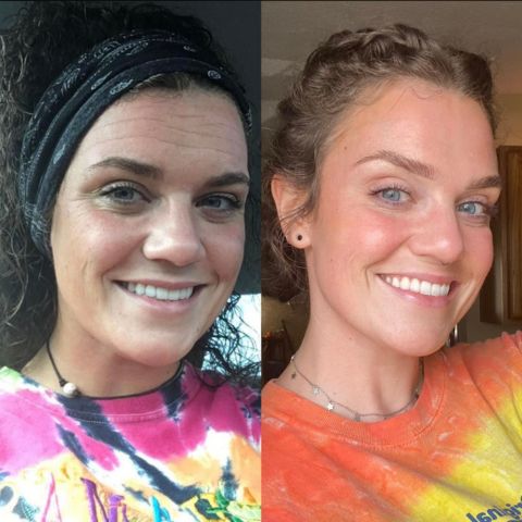 🎁PAGA 1 lleva 2 rollos de silicona para cicatrices 1.20 Metros largo