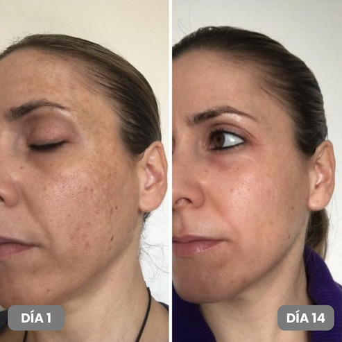 Sérum Anti-manchas con Centella Asiática