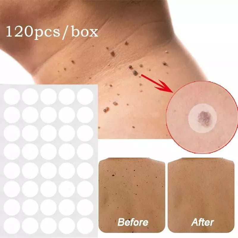 Parches de eliminación de verrugas