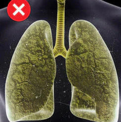 Gotas suplemento  de extracto de hoja de Mullein + de clorofila para pulmones