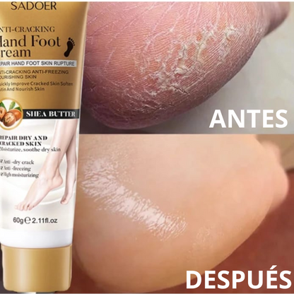 SADOER - Crema hidratante aclarante manos y pies