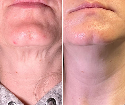 Crema para Cuello - Reafirmante y Lifting