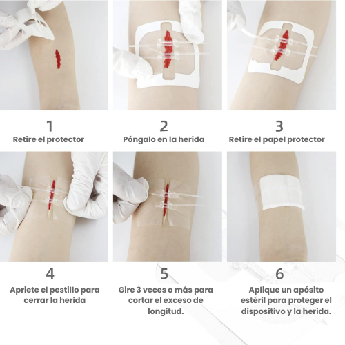 Kit de cierre de heridas sin costura RHINO RESCUE