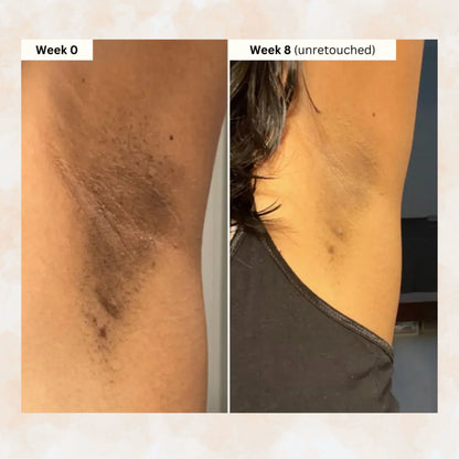 Cúrcuma y kójico: jabón iluminador para una piel clara y uniforme