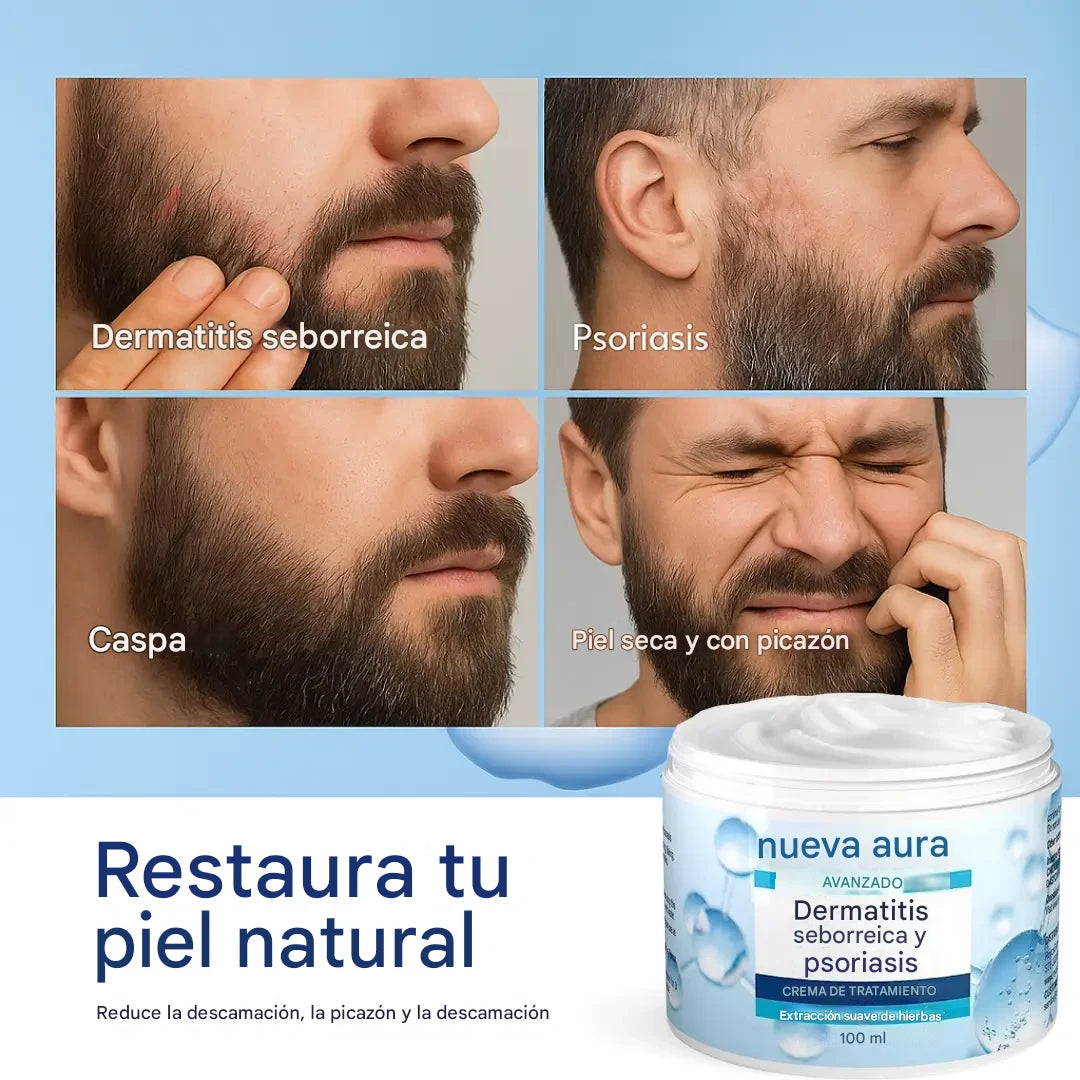 New aura Crema para la dermatitis seborreica y la psoriasis