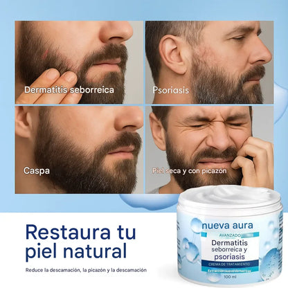 New aura Crema para la dermatitis seborreica y la psoriasis