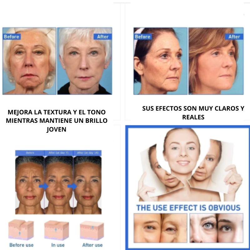 Suero facial ácido hiarulonico