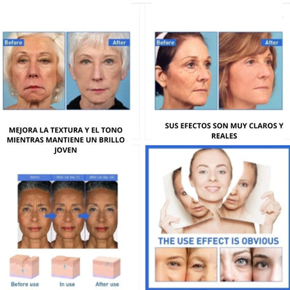 Suero facial ácido hiarulonico