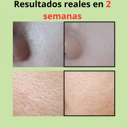 GreenTomate - Esencia reparadora de poros de tomate verde