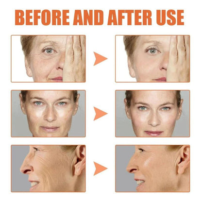 SUERO DE ESENCIA FACIAL ANTIENVEJECIMIENTO BOTOX