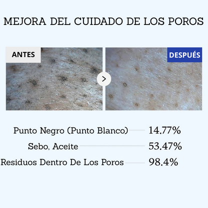 Zero pore mascarilla de barro limpiadora