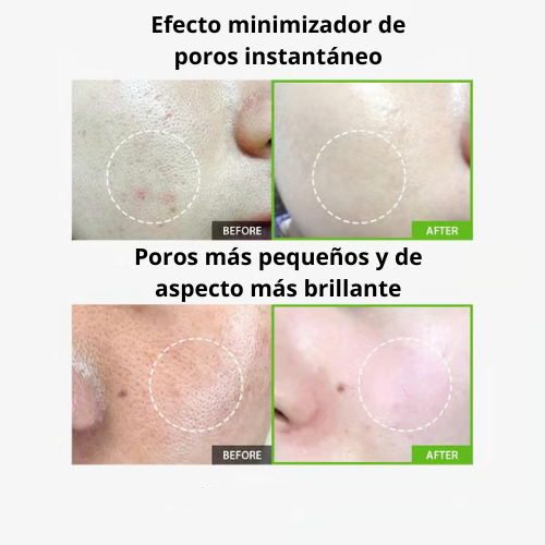 GreenTomate - Esencia reparadora de poros de tomate verde