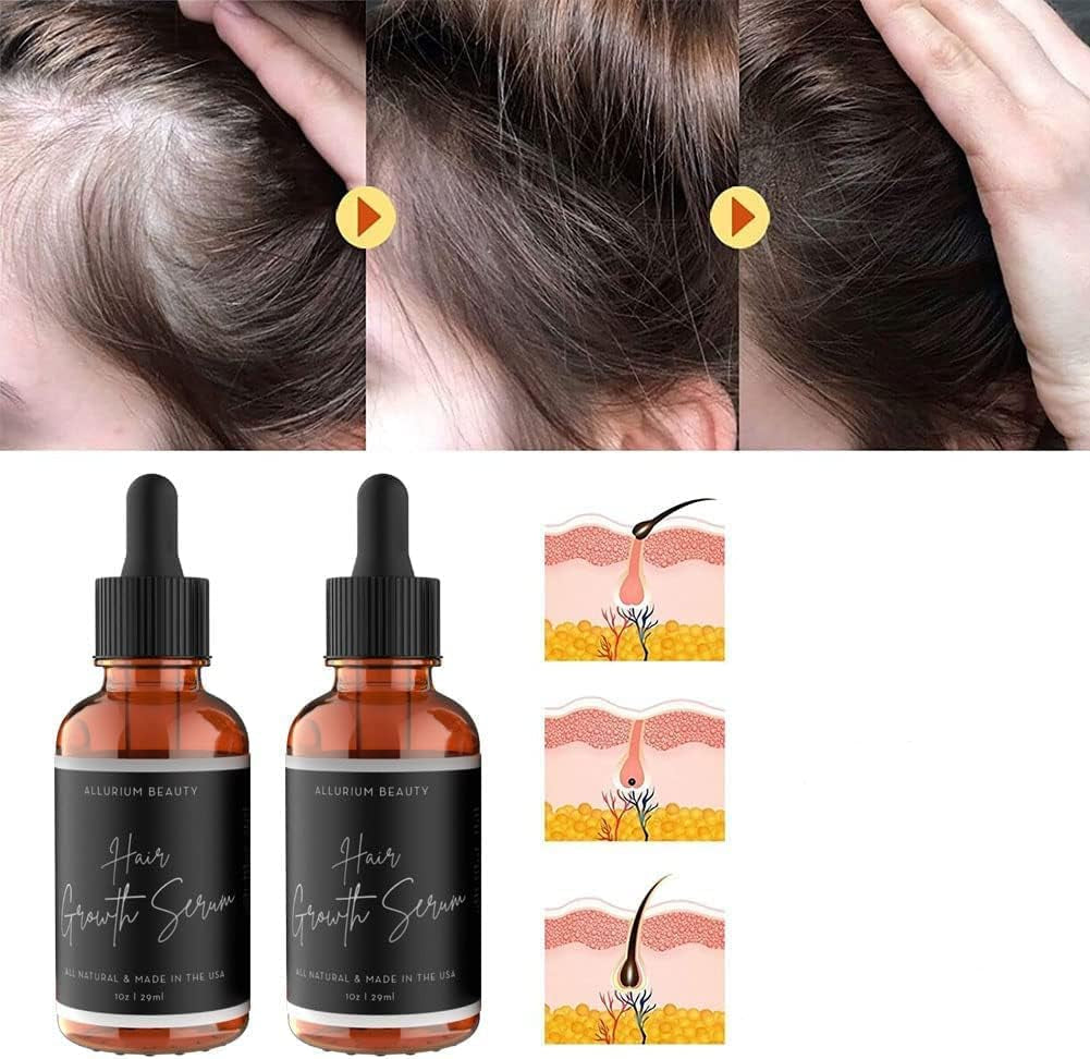 HairGrouth Serum para crecimiento de cabello, anticaída, fortalecimiento