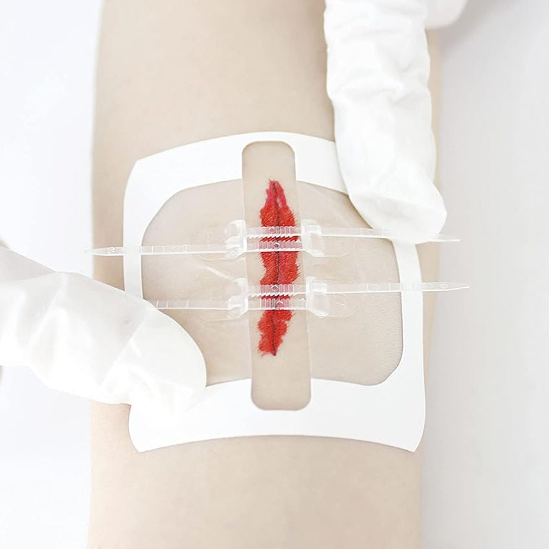 Kit de cierre de heridas sin costura RHINO RESCUE