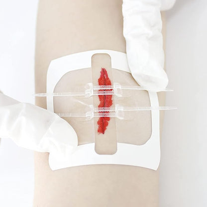 Kit de cierre de heridas sin costura RHINO RESCUE