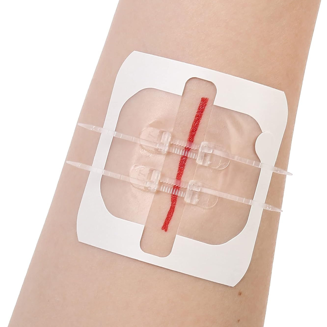 Kit de cierre de heridas sin costura RHINO RESCUE