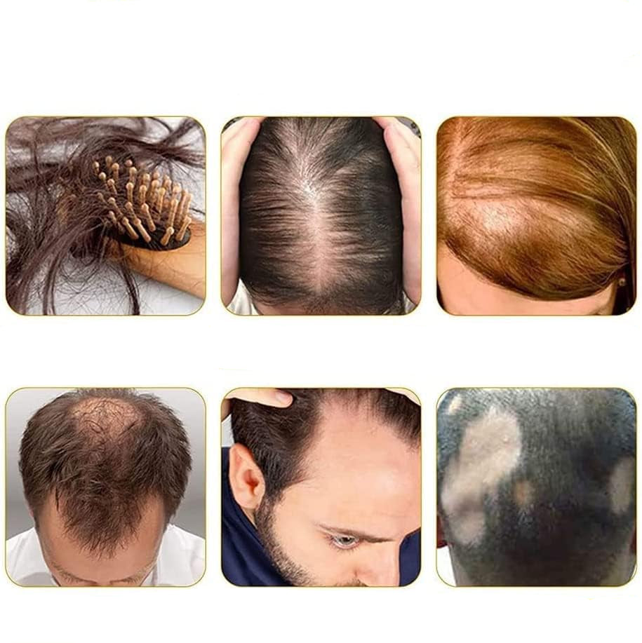 HairGrouth Serum para crecimiento de cabello, anticaída, fortalecimiento