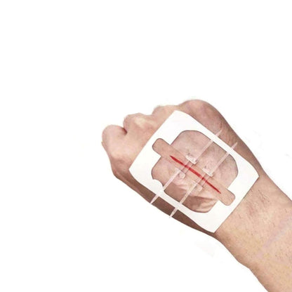 Kit de cierre de heridas sin costura RHINO RESCUE