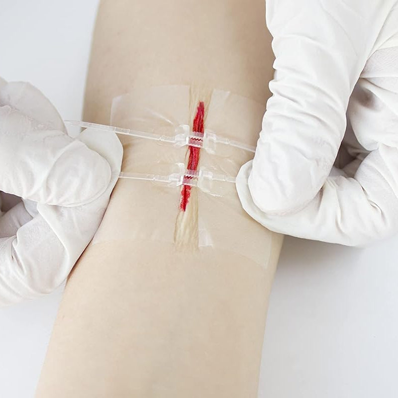 Kit de cierre de heridas sin costura RHINO RESCUE