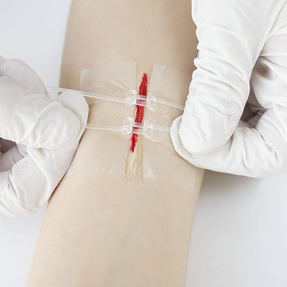 Kit de cierre de heridas sin costura RHINO RESCUE