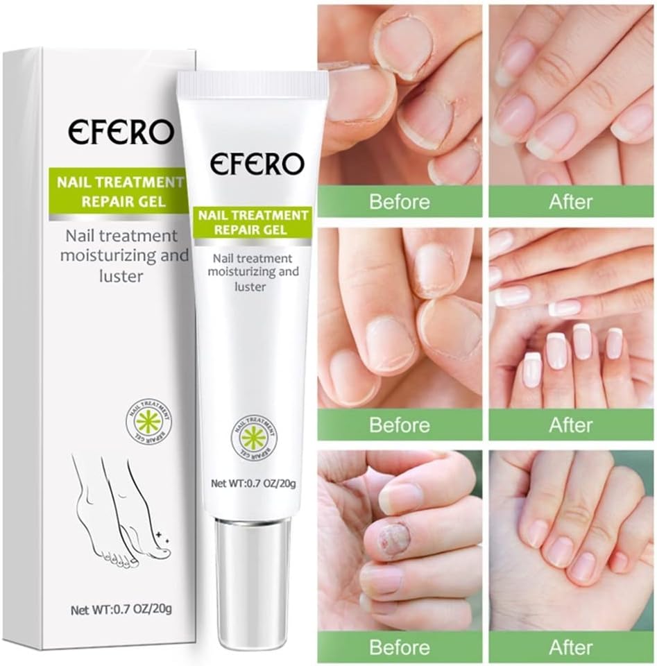 Eliminador de hongos de las uñas onicomicosis