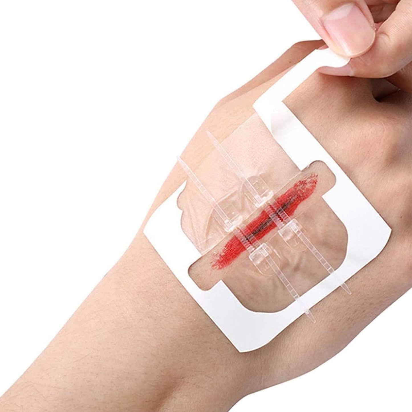 Kit de cierre de heridas sin costura RHINO RESCUE