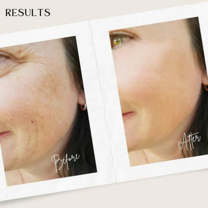 SUERO DE ESENCIA FACIAL ANTIENVEJECIMIENTO BOTOX