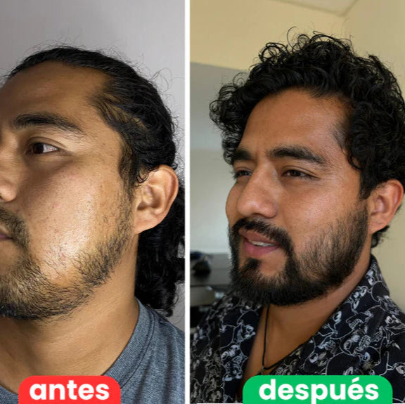 Bálsamo para Crecimiento de Barba Ultra Potente con Minoxidil 20% | 100mL