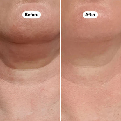 Suero reafirmante para el cuello