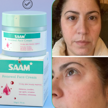 SAAM Crema facial renovadora - elimina melasma, pecas, manchas de la edad