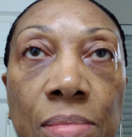 SAAM Crema facial renovadora - elimina melasma, pecas, manchas de la edad