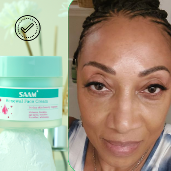 SAAM Crema facial renovadora - elimina melasma, pecas, manchas de la edad