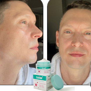 SAAM Crema facial renovadora - elimina melasma, pecas, manchas de la edad