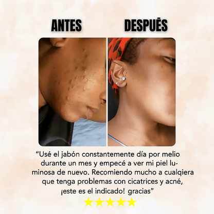 Cúrcuma y kójico: jabón iluminador para una piel clara y uniforme