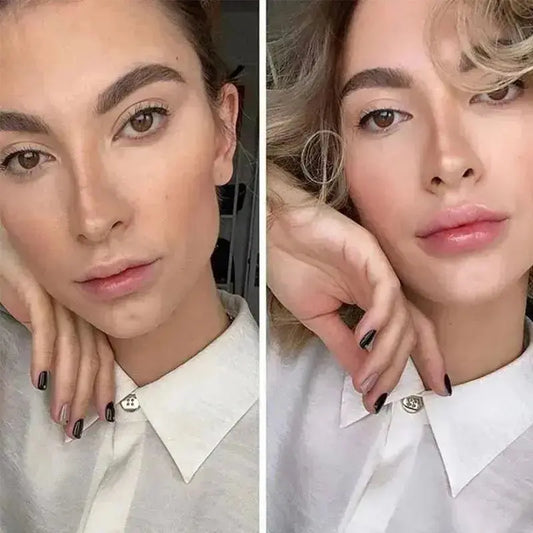 LIPBOOST - Microagujas para labios carnosos, líneas finas suavizadas