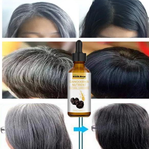 🚨GRAN LANZAMIENTO⚡️ - SOUTH MOON™️ SERUM ANTICANAS