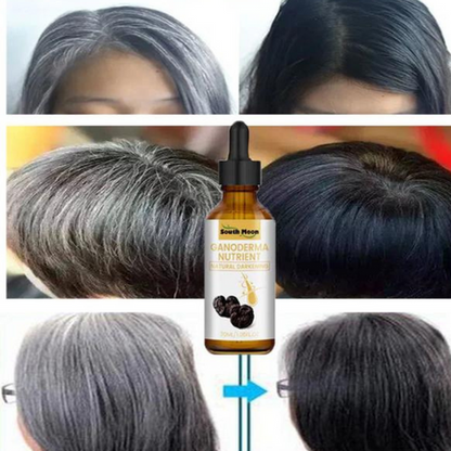 🚨GRAN LANZAMIENTO⚡️ - SOUTH MOON™️ SERUM ANTICANAS