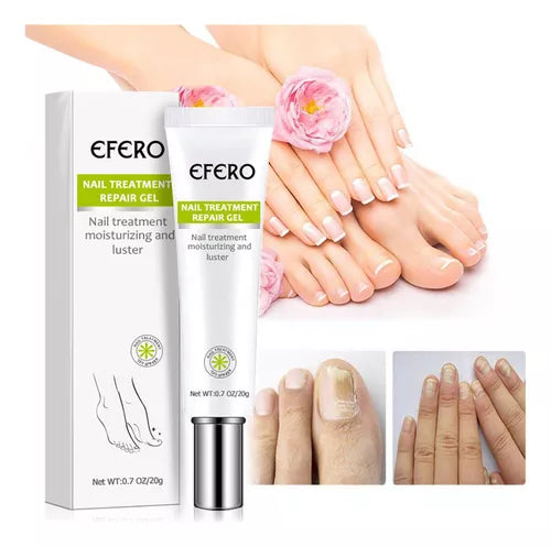 Eliminador de hongos de las uñas onicomicosis