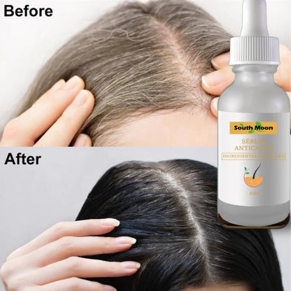 🚨GRAN LANZAMIENTO⚡️ - SOUTH MOON™️ SERUM ANTICANAS