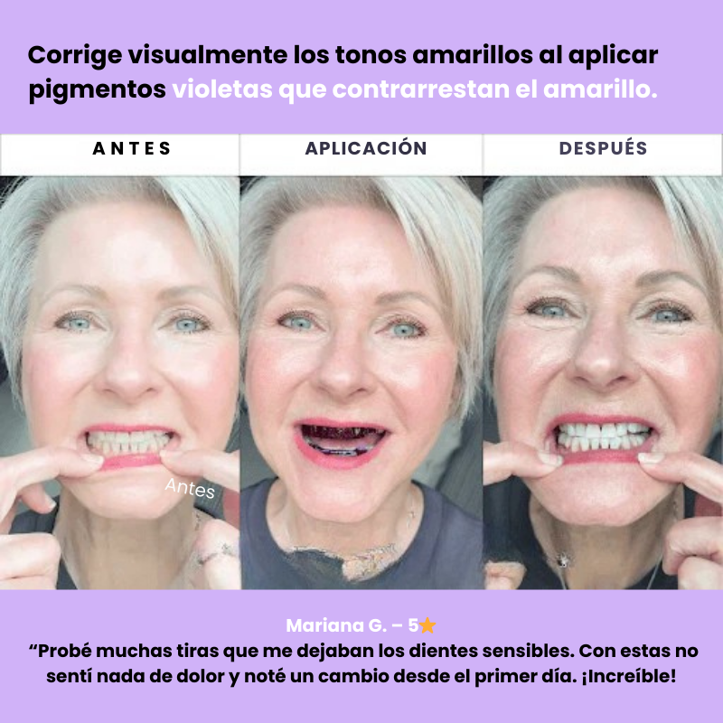 Hismile Tiras blanqueadoras