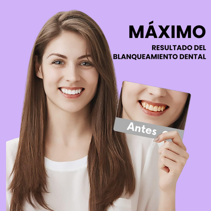 Hismile Tiras blanqueadoras