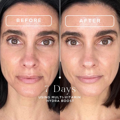 HYDRA BOOST MULTIVITAMÍNICO TRATAMIENTO 7 DÍAS
