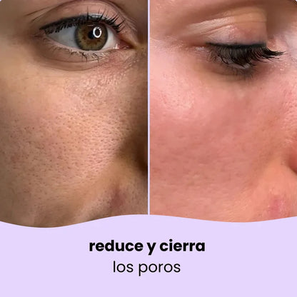 Almohadillas de curcuma y acido kojico - exfolia y nutre la piel (PACK DE 40)