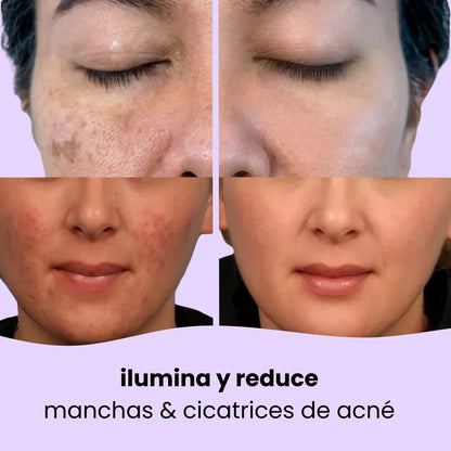 Almohadillas de curcuma y acido kojico - exfolia y nutre la piel (PACK DE 40)