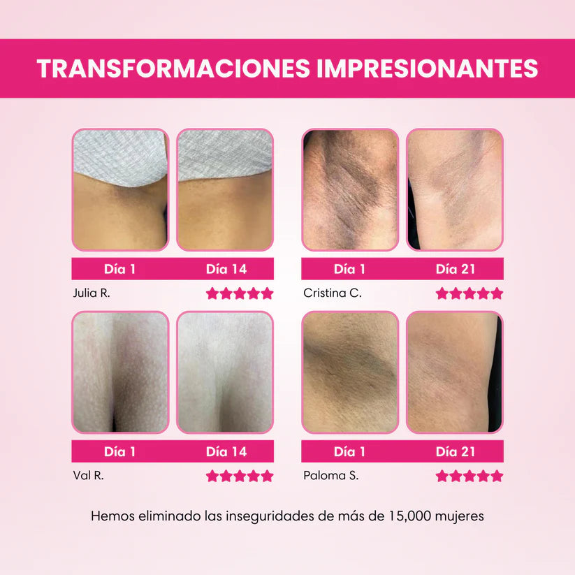 Skinglow Crema Aclarante