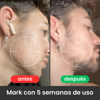 Bálsamo para Crecimiento de Barba Ultra Potente con Minoxidil 20% | 100mL