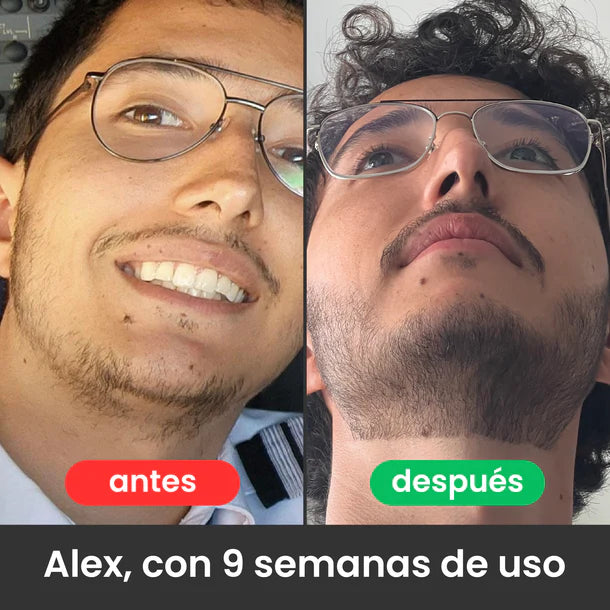 Bálsamo para Crecimiento de Barba Ultra Potente con Minoxidil 20% | 100mL