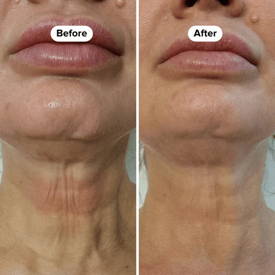 Suero reafirmante para el cuello