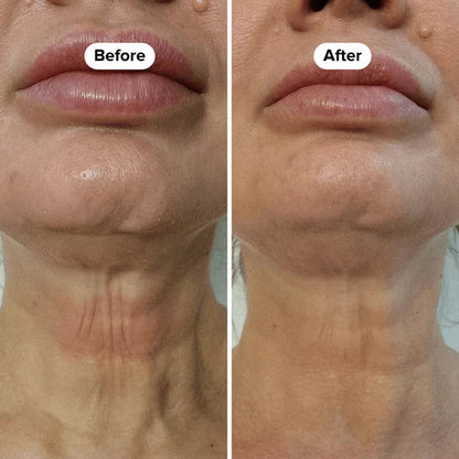 Suero reafirmante para el cuello